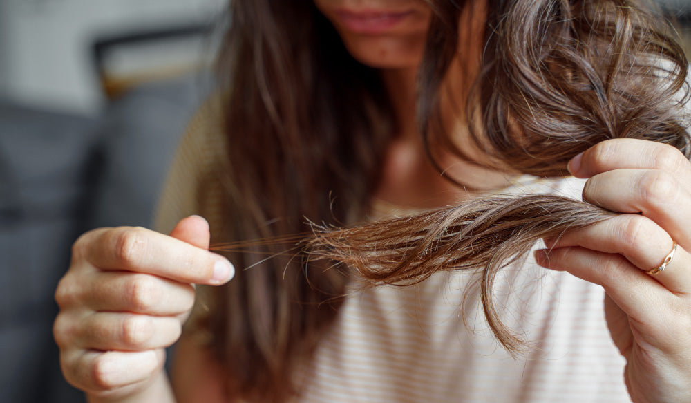 What You Need to Know About Hair Loss